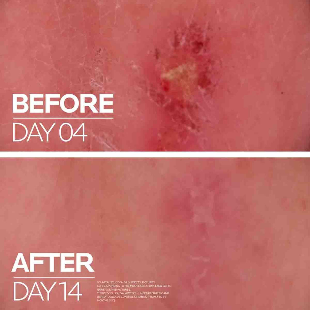 La Roche-Posay Cicaplast Baume B5+